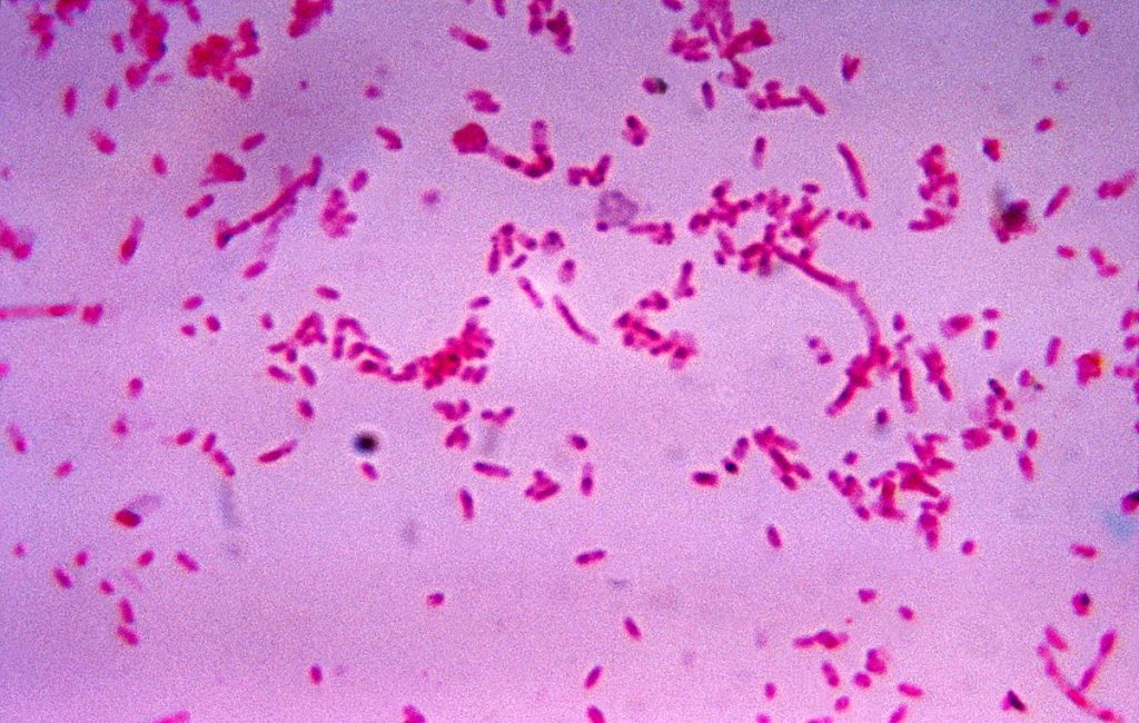 Vi khuẩn Fusobacterium